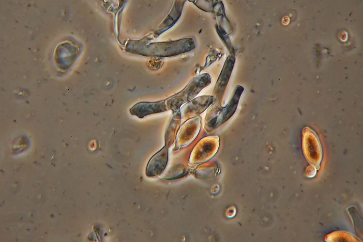 Botryobasidium aureum e il suo anamorfo Haplotrichum aureum